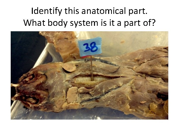 Identify this anatomical part. What body system is it a part of? 