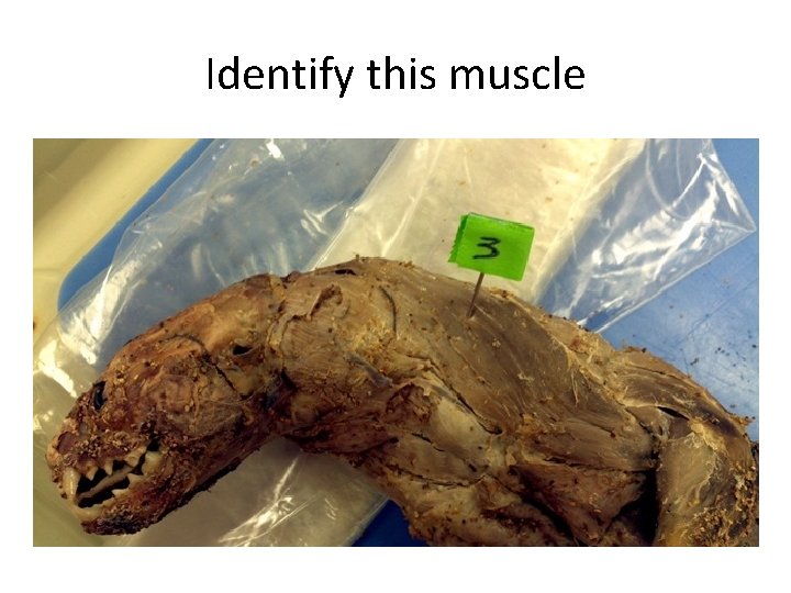 Identify this muscle 