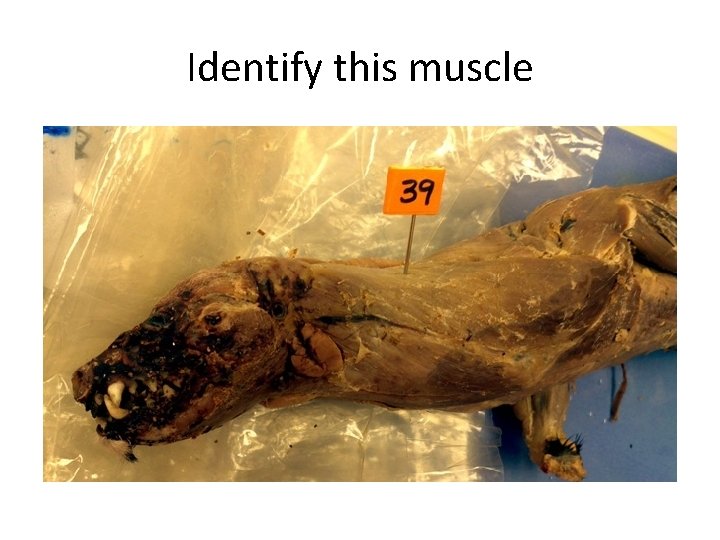 Identify this muscle 