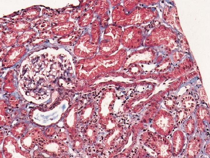 Anatomia prawidłowa kłębuszka, naczyń i cewek nerkowych 