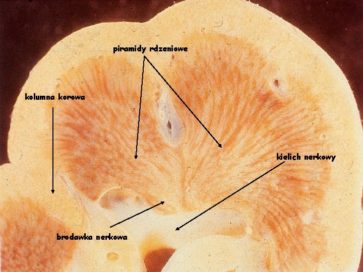 piramidy rdzeniowe kolumna korowa kielich nerkowy brodawka nerkowa 