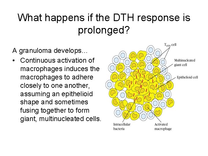 What happens if the DTH response is prolonged? A granuloma develops… • Continuous activation