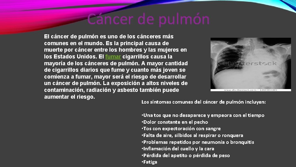Cáncer de pulmón El cáncer de pulmón es uno de los cánceres más comunes