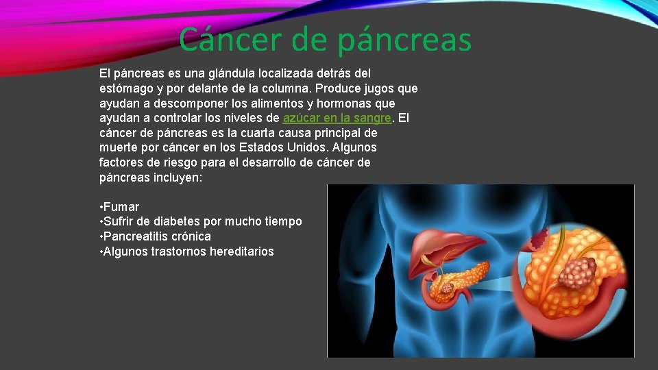 Cáncer de páncreas El páncreas es una glándula localizada detrás del estómago y por