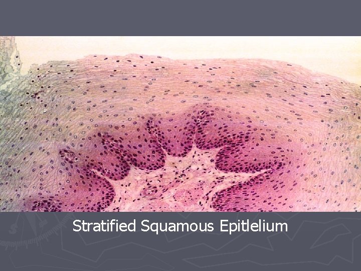 Stratified Squamous Epitlelium 