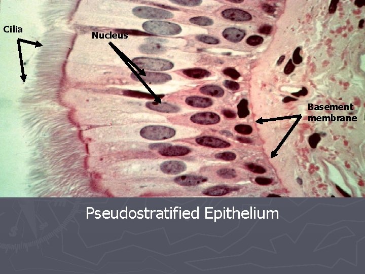 Cilia Nucleus Basement membrane Pseudostratified Epithelium 
