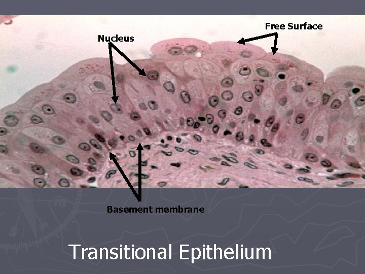 Free Surface Nucleus Basement membrane Transitional Epithelium 