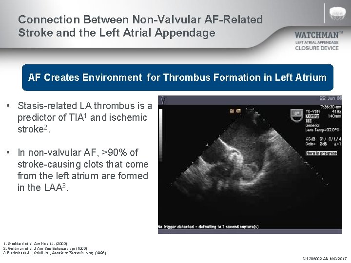 Connection Between Non-Valvular AF-Related Stroke and the Left Atrial Appendage AF Creates Environment for