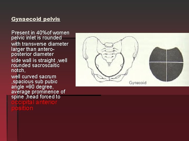 Gynaecoid pelvis Present in 40%of women pelvic inlet is rounded with transverse diameter larger