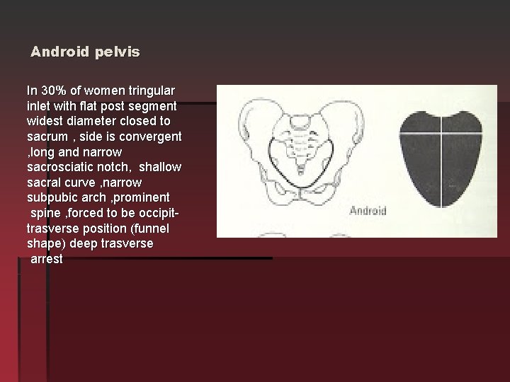 Android pelvis In 30% of women tringular inlet with flat post segment widest diameter