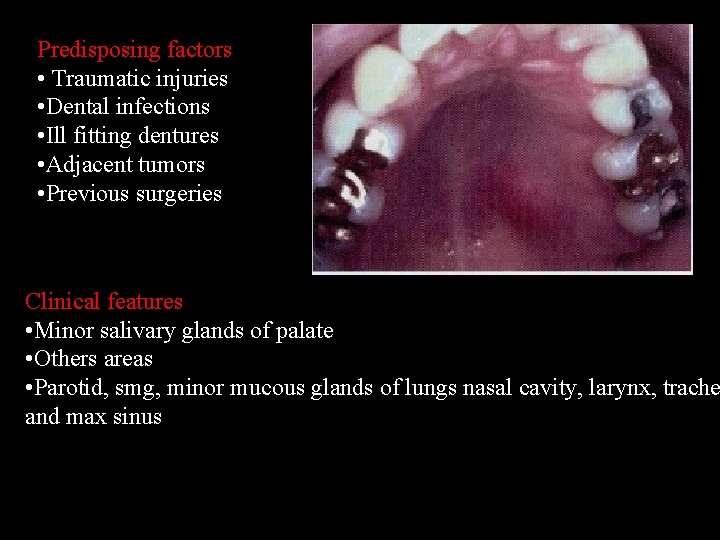 Predisposing factors • Traumatic injuries • Dental infections • Ill fitting dentures • Adjacent