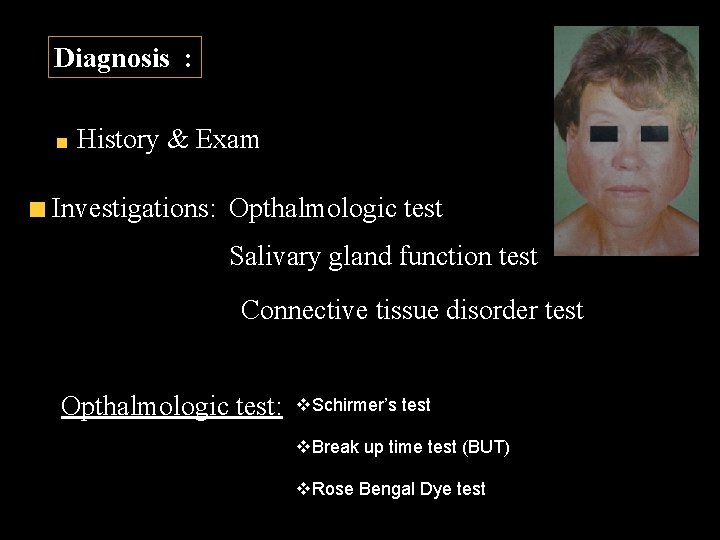 Diagnosis : History & Exam Investigations: Opthalmologic test Salivary gland function test Connective tissue