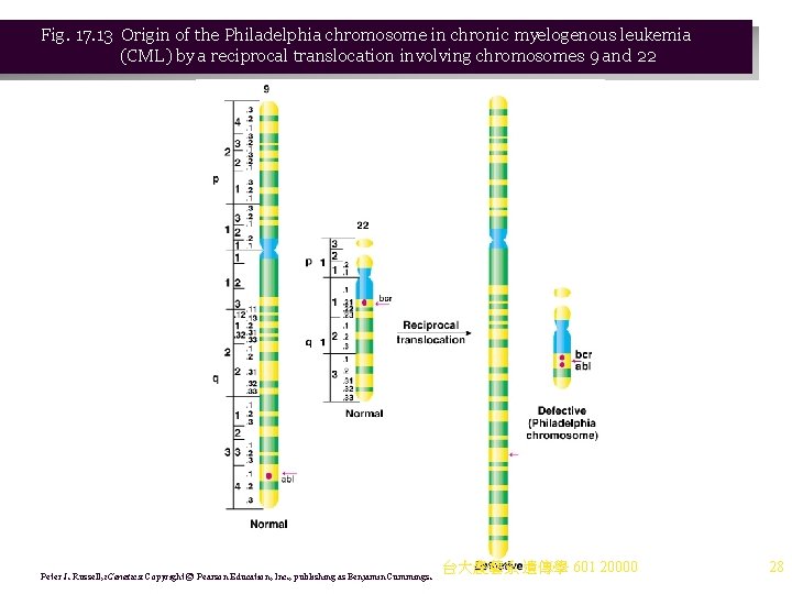 Fig. 17. 13 Origin of the Philadelphia chromosome in chronic myelogenous leukemia (CML) by Fig. 17. 13 Origin of the Philadelphia chromosome in chronic myelogenous leukemia (CML) by