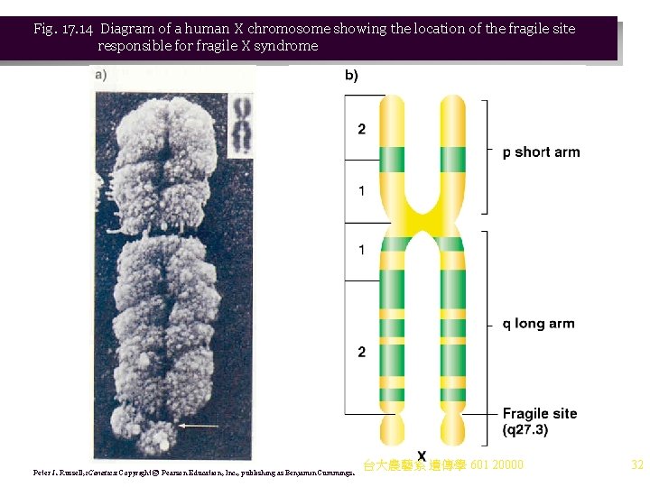 Fig. 17. 14 Diagram of a human X chromosome showing the location of the Fig. 17. 14 Diagram of a human X chromosome showing the location of the
