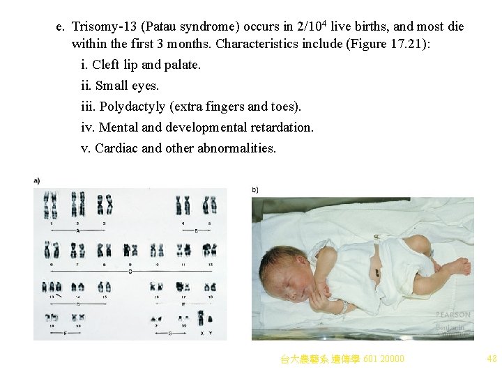 e. Trisomy-13 (Patau syndrome) occurs in 2/104 live births, and most die within the e. Trisomy-13 (Patau syndrome) occurs in 2/104 live births, and most die within the