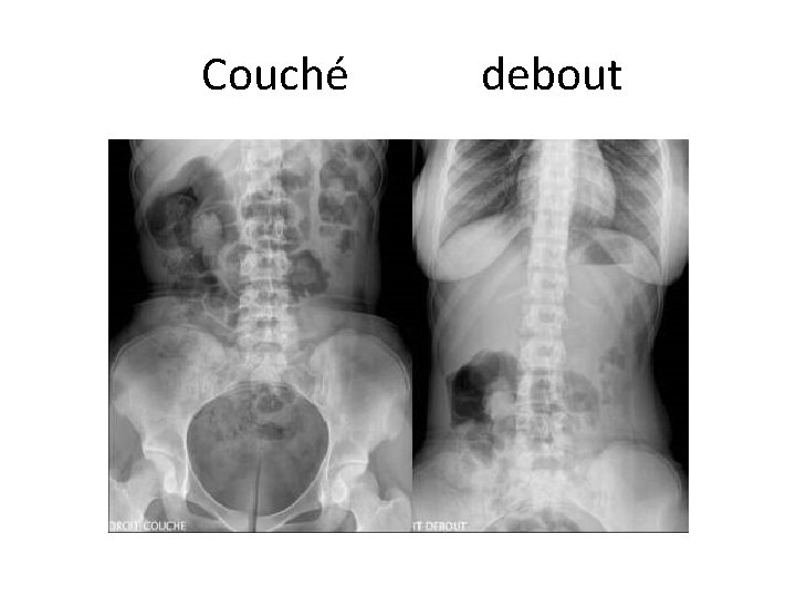 Couché debout 