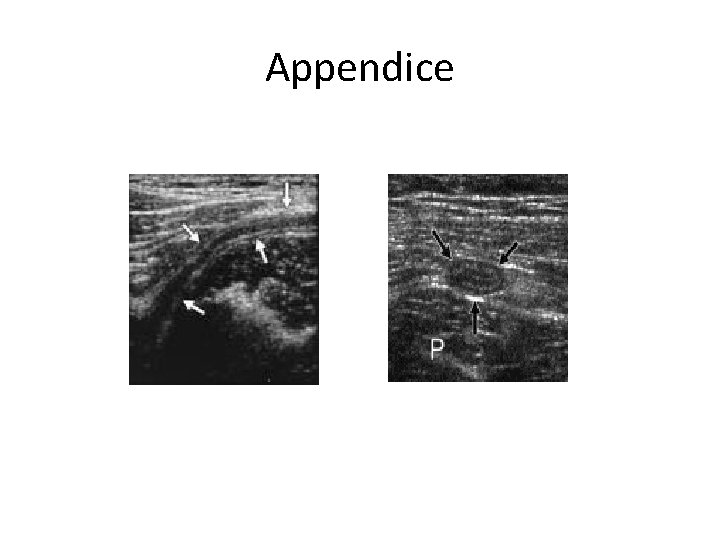 Appendice 