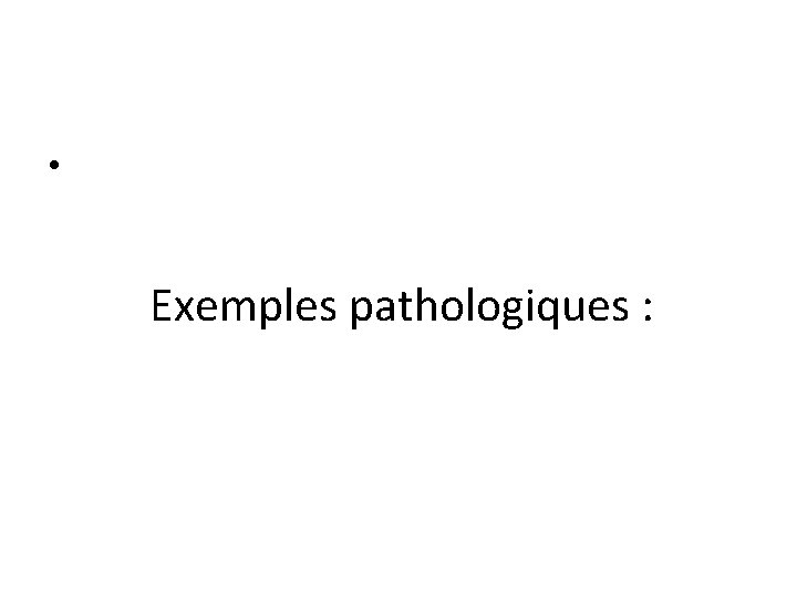 • Exemples pathologiques : 