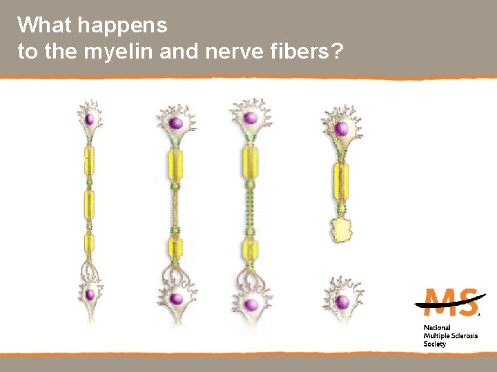 What happens to the myelin and nerve fibers? 