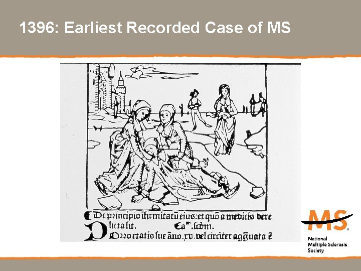 1396: Earliest Recorded Case of MS 