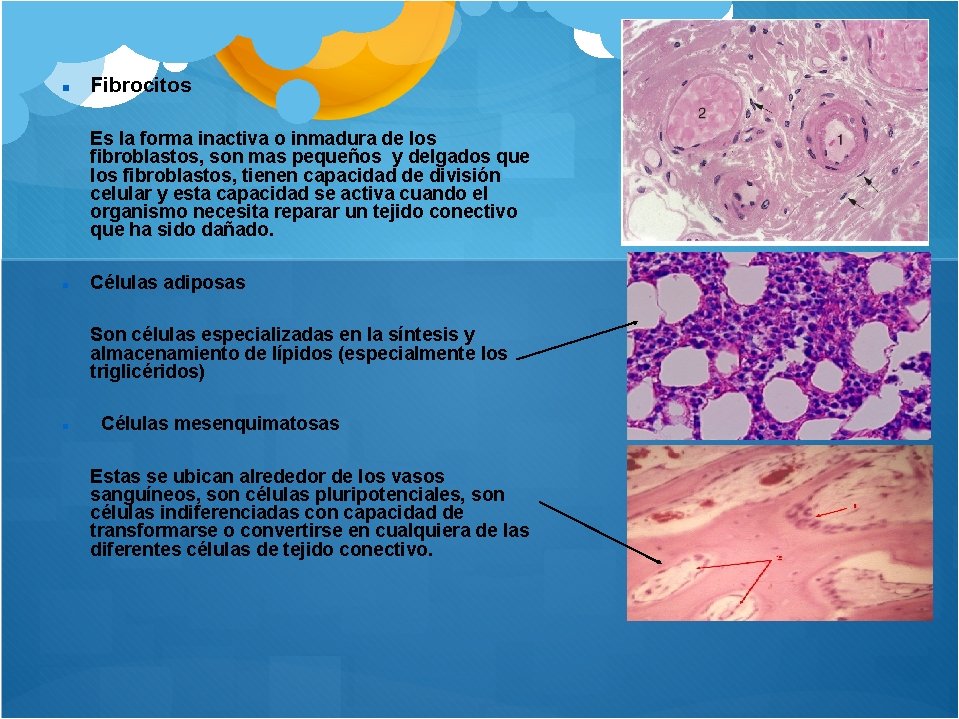  Fibrocitos Es la forma inactiva o inmadura de los fibroblastos, son mas pequeños