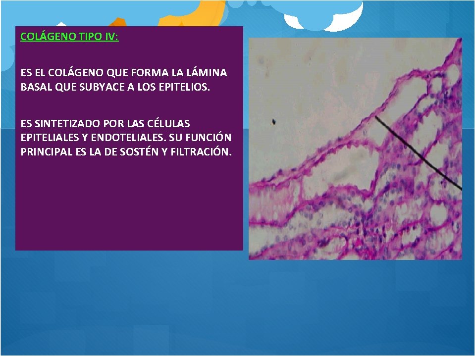 COLÁGENO TIPO IV: ES EL COLÁGENO QUE FORMA LA LÁMINA BASAL QUE SUBYACE A