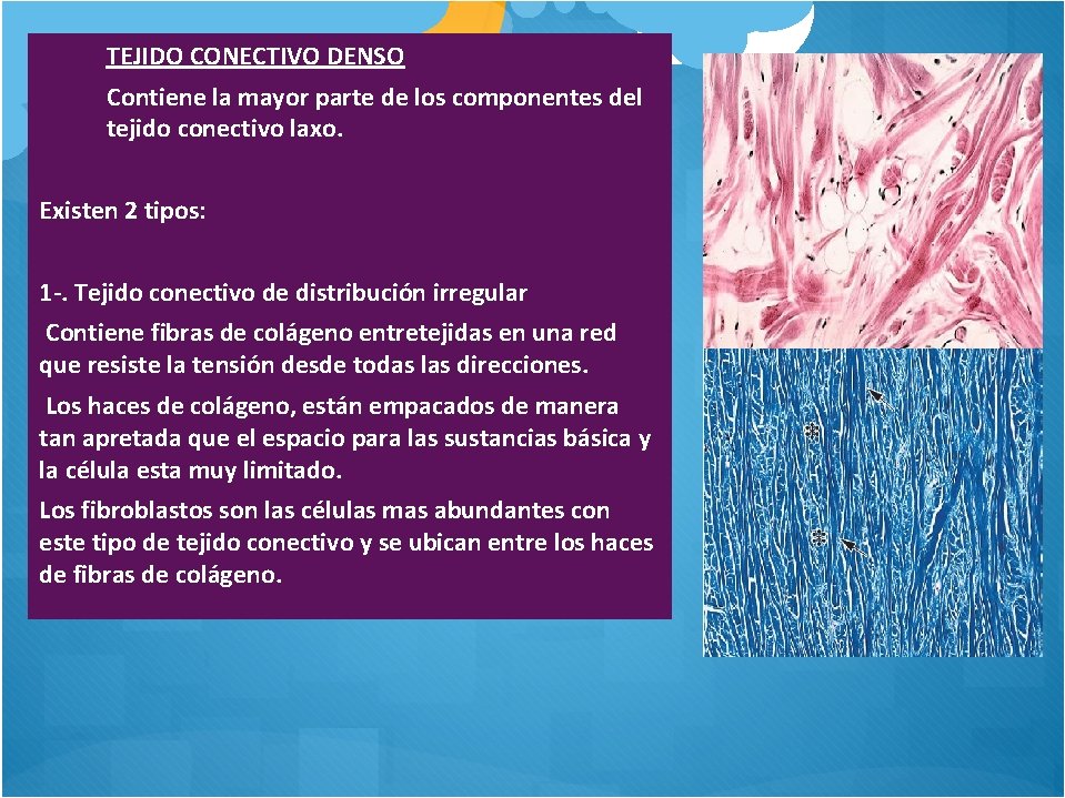 TEJIDO CONECTIVO DENSO Contiene la mayor parte de los componentes del tejido conectivo laxo.