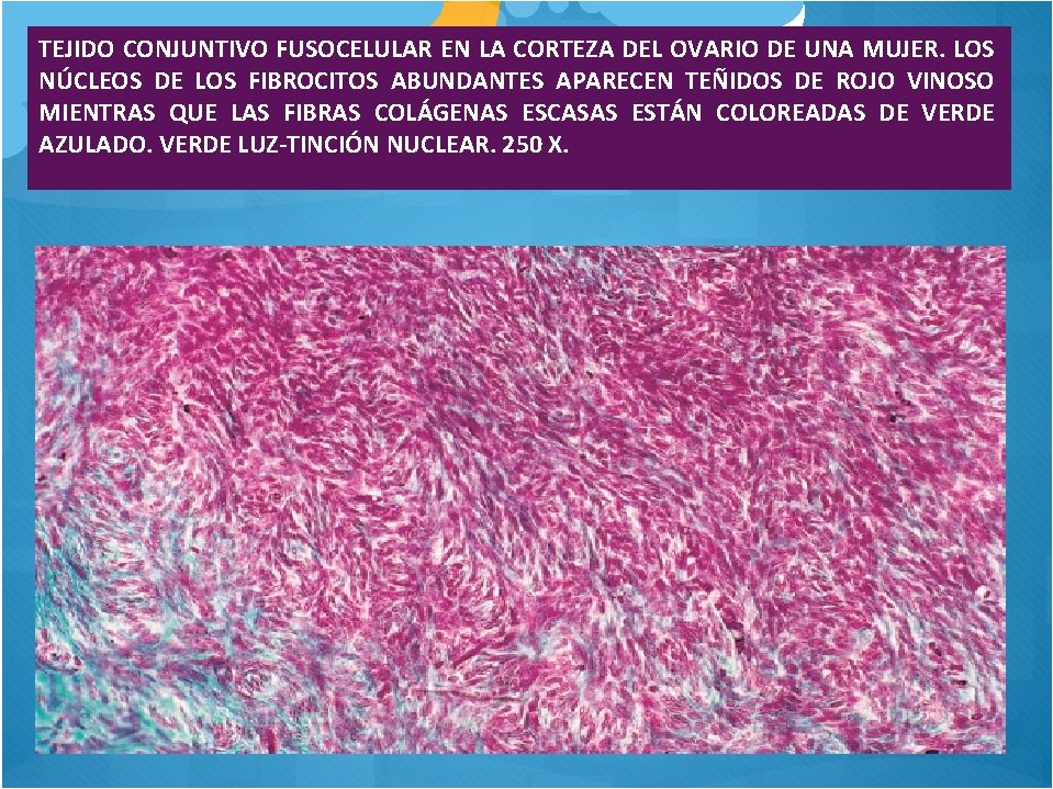 TEJIDO CONJUNTIVO FUSOCELULAR EN LA CORTEZA DEL OVARIO DE UNA MUJER. LOS NÚCLEOS DE