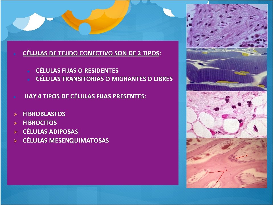 CÉLULAS DE TEJIDO CONECTIVO SON DE 2 TIPOS: CÉLULAS FIJAS O RESIDENTES CÉLULAS