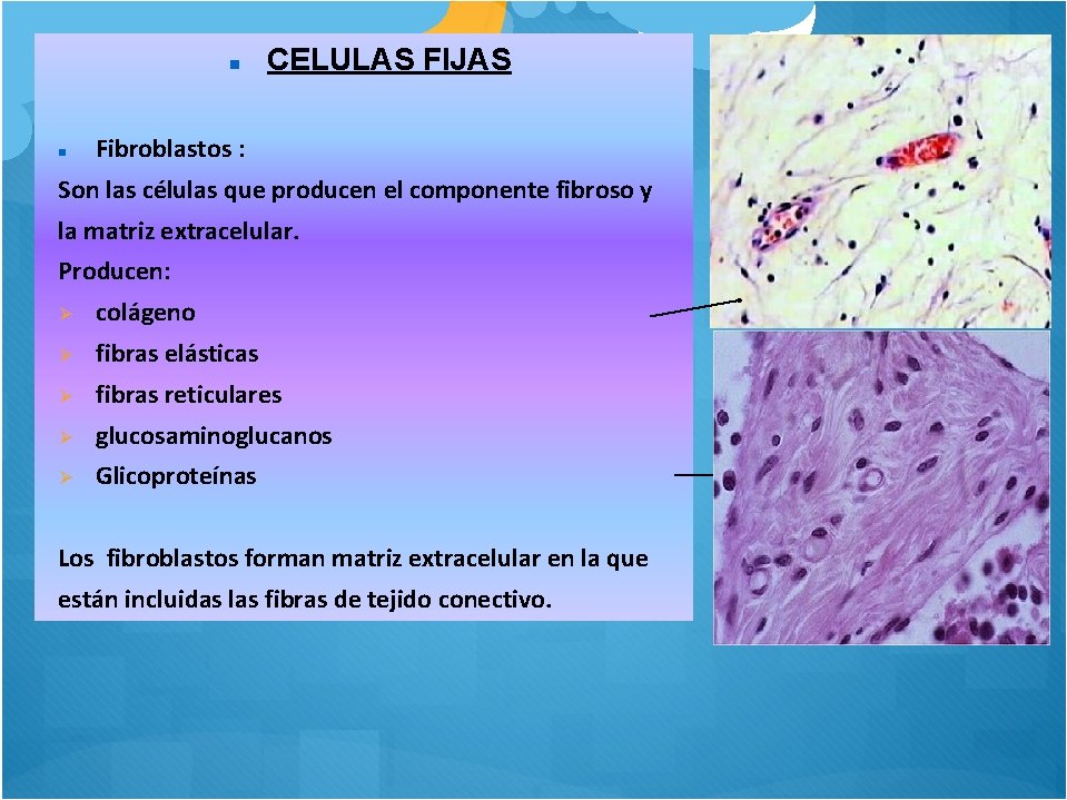  CELULAS FIJAS Fibroblastos : Son las células que producen el componente fibroso y