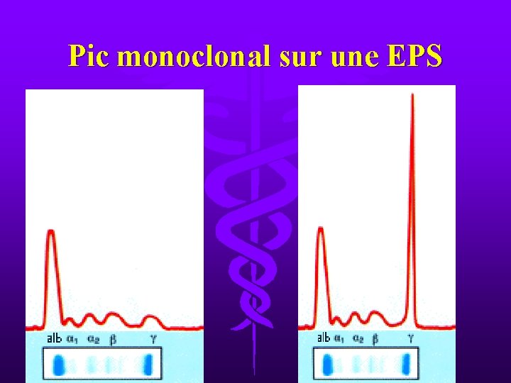 Pic monoclonal sur une EPS 