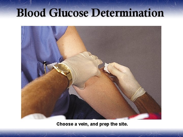 Blood Glucose Determination Choose a vein, and prep the site. 