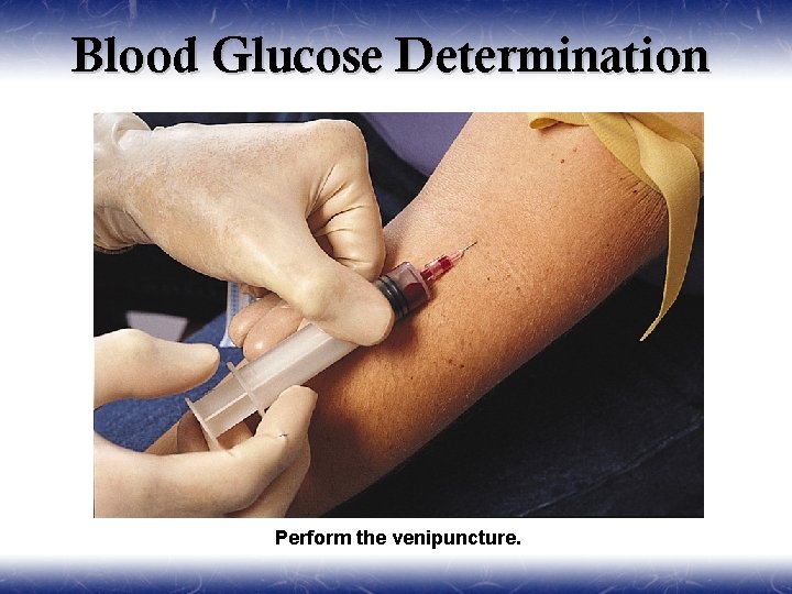 Blood Glucose Determination Perform the venipuncture. 