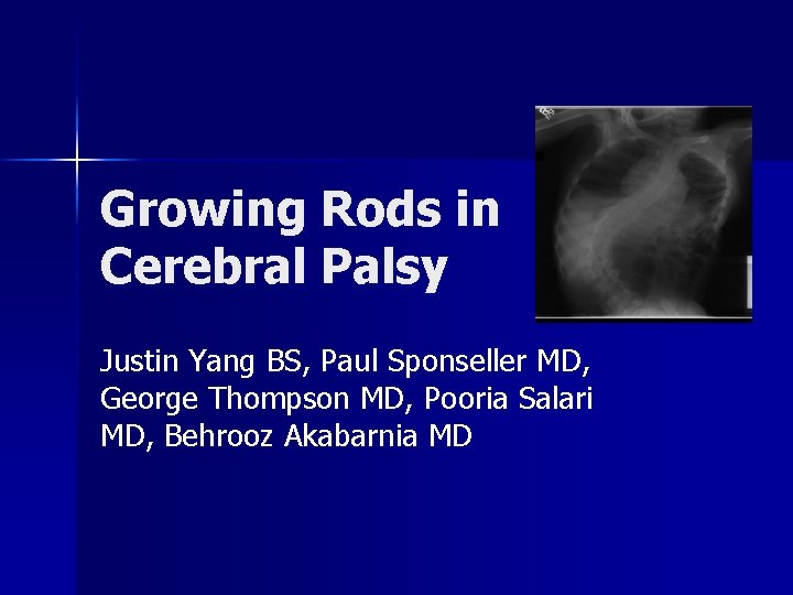 Growing Rods in Cerebral Palsy Justin Yang BS, Paul Sponseller MD, George Thompson MD,