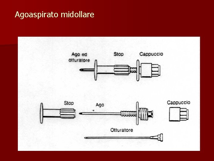 Agoaspirato midollare 