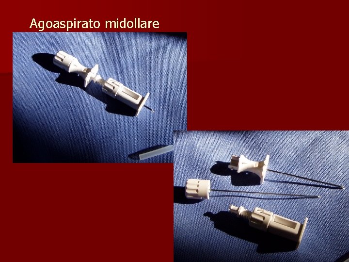 Agoaspirato midollare 