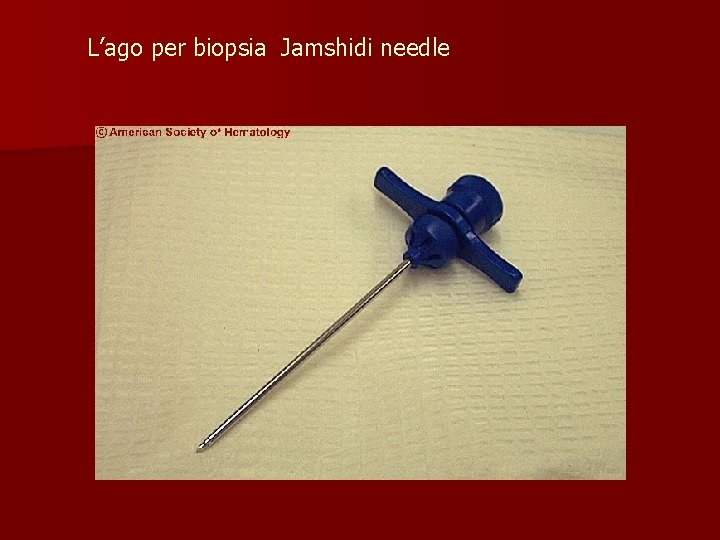 L’ago per biopsia Jamshidi needle 