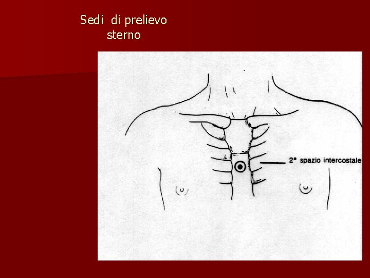 Sedi di prelievo sterno 