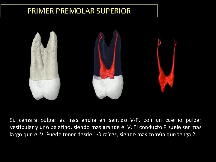 PRIMER PREMOLAR SUPERIOR Su cámara pulpar es mas ancha en sentido V-P, con un