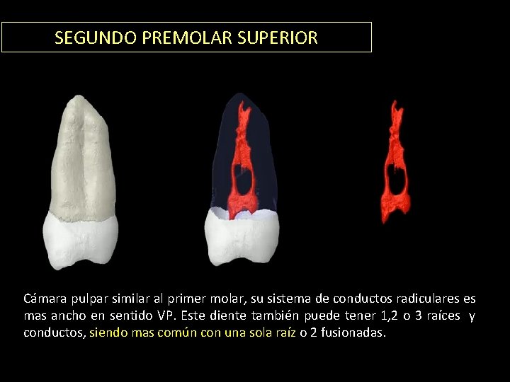 SEGUNDO PREMOLAR SUPERIOR Cámara pulpar similar al primer molar, su sistema de conductos radiculares