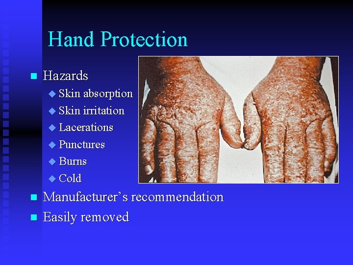 Hand Protection n Hazards u Skin absorption u Skin irritation u Lacerations u Punctures Hand Protection n Hazards u Skin absorption u Skin irritation u Lacerations u Punctures