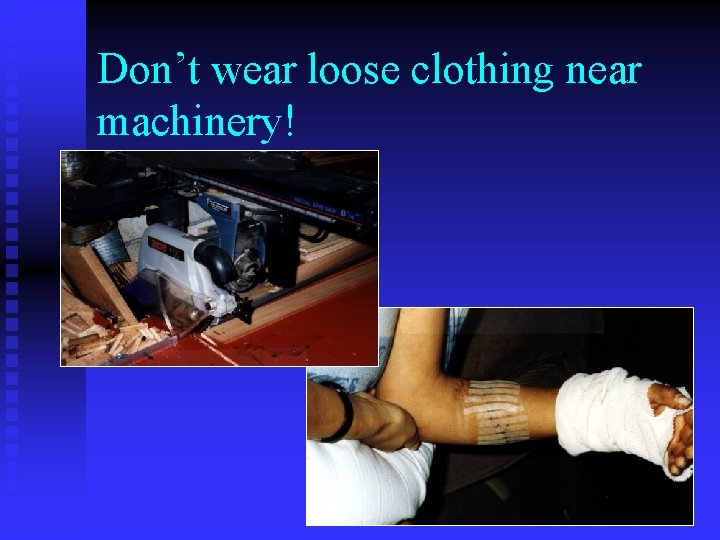 Don’t wear loose clothing near machinery! Don’t wear loose clothing near machinery!