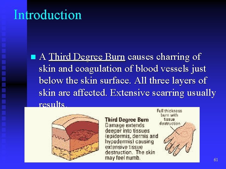 Introduction n A Third Degree Burn causes charring of skin and coagulation of blood Introduction n A Third Degree Burn causes charring of skin and coagulation of blood