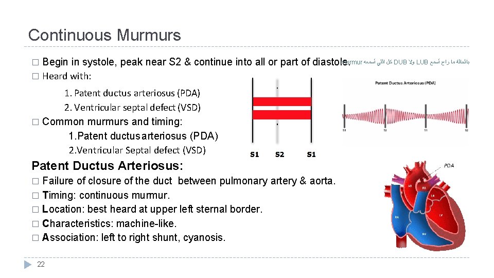 Continuous Murmurs murmur ﺃﺴﻤﻌﻪ ﺍﻟﻠﻲ ﻛﻞ DUB ﻭﻻ LUB ﺃﺴﻤﻊ ﺭﺍﺡ ﻣﺎ ﺑﺎﻟﺤﺎﻟﺔ Begin