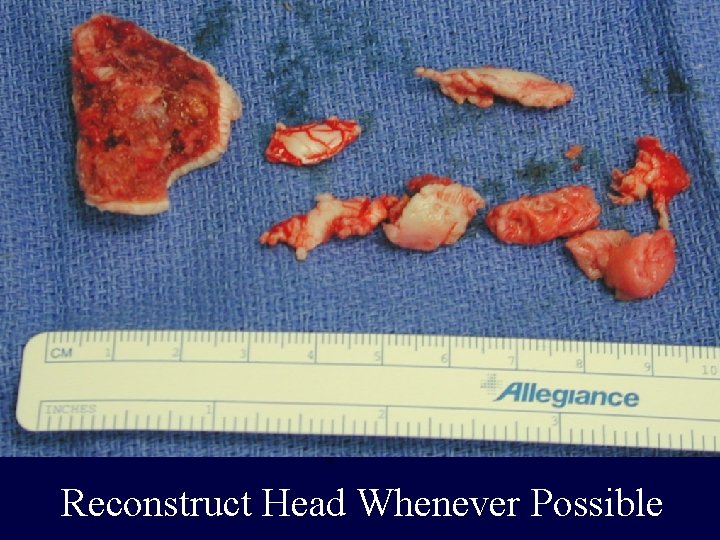 Reconstruct Head Whenever Possible 