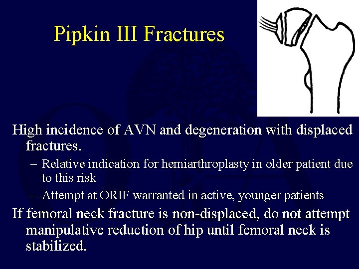 Pipkin III Fractures High incidence of AVN and degeneration with displaced fractures. – Relative