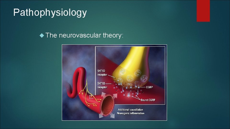 Pathophysiology The neurovascular theory: Pathophysiology The neurovascular theory: