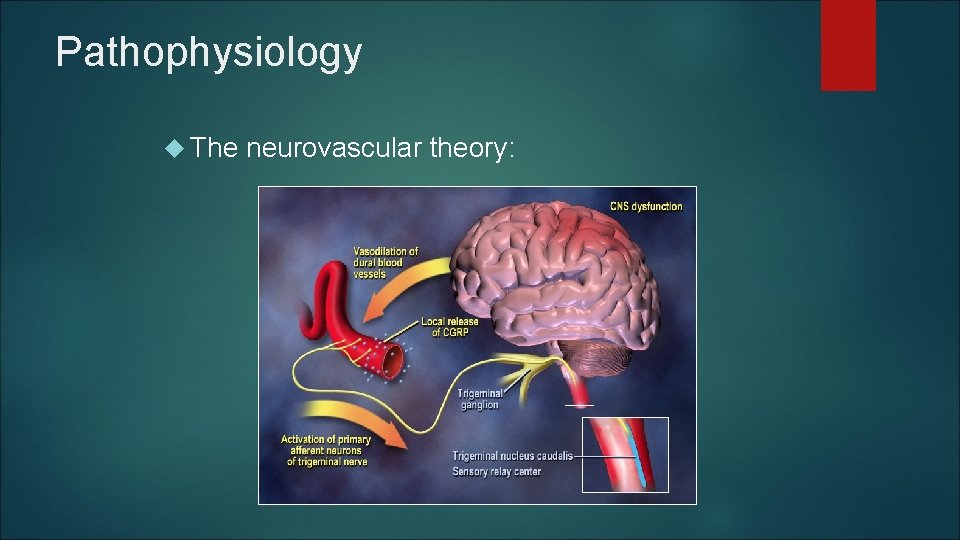 Pathophysiology The neurovascular theory: Pathophysiology The neurovascular theory: