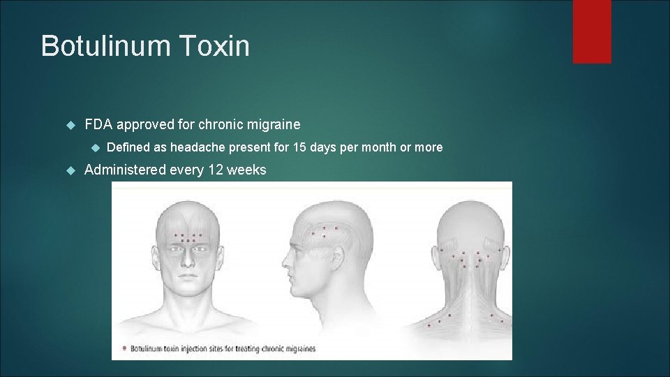 Botulinum Toxin FDA approved for chronic migraine Defined as headache present for 15 days Botulinum Toxin FDA approved for chronic migraine Defined as headache present for 15 days