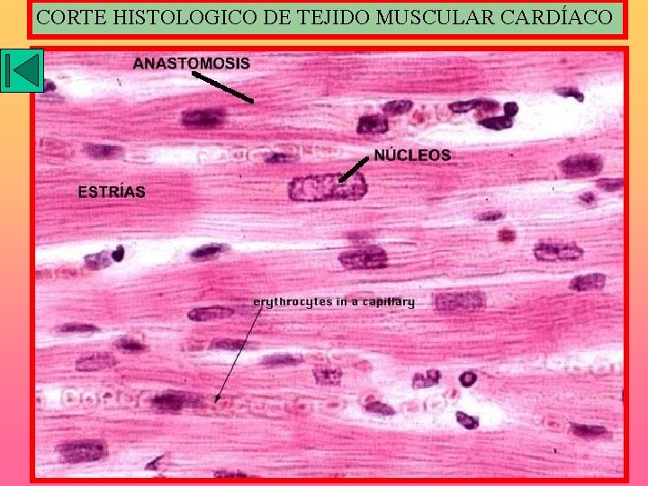 CORTE HISTOLOGICO DE TEJIDO MUSCULAR CARDÍACO 